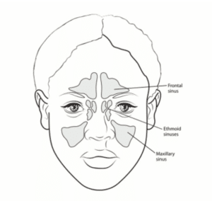 nasal cancer surgery2